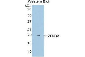 Western Blotting (WB) image for anti-Centromere Protein E, 312kDa (CENPE) (AA 2222-2361) antibody (ABIN1858364) (CENPE antibody  (AA 2222-2361))