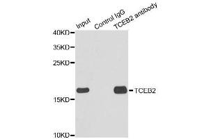 Immunoprecipitation analysis of 150ug extracts of MCF7 cells using 3ug TCEB2 antibody. (TCEB2 antibody  (AA 1-118))