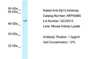 WB Suggested Anti-Zfp72 Antibody   Titration: 1. (Zfp72 antibody  (N-Term))