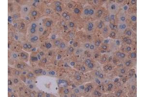Immunohistochemistry (IHC) image for anti-Interleukin-27 subunit beta (IL-27b) (AA 19-228) antibody (ABIN1867674)
