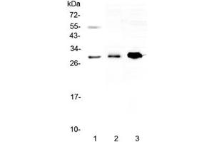 Western blot testing of 1) human 22RV1, 2) rat skeletal muscle and 3) mouse HEPA1-6 lysate with VEGFB antibody at 0. (VEGFB (VEGF2) antibody)