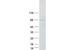 Western Blotting (WB) image for Fibroblast Growth Factor Receptor Substrate 2 (FRS2) (Transcript Variant 1) protein (Myc-DYKDDDDK Tag) (ABIN2721422)