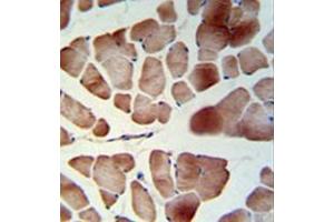 Immunohistochemistry analysis in formalin fixed and paraffin embedded skeletal muscle reacted with PATL1 Antibody (C-term) followed which was peroxidase conjugated to the secondary antibody and followed by DAB staining.