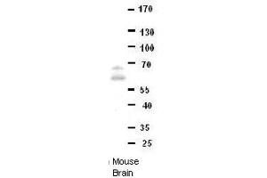 DONSON antibody - middle region  validated by WB using Mouse brains at 1:1000. (DONSON antibody  (Middle Region))