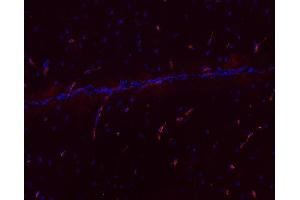 Indirect immunofluorescence labeling of PFA fixed, paraffin embedded mouse brain section (dilution 1 : 500; red). (MCTS1 antibody)