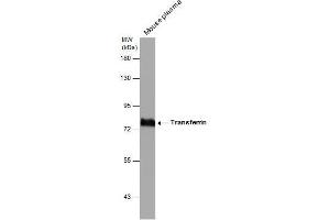 WB Image Mouse tissue extract (50 μg) was separated by 7. (Transferrin antibody)