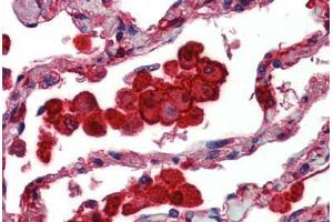 Human Lung: Formalin-Fixed, Paraffin-Embedded (FFPE) (Caspase 12 antibody)