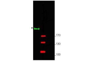Western blot using  Affinity Purified anti-Gli-2 antibody shows detection of a predominant band at ~190 kDa corresponding to Gli-2 (arrowhead) in mouse brain whole cell lysate (lane 1). (GLI2 antibody  (Internal Region))