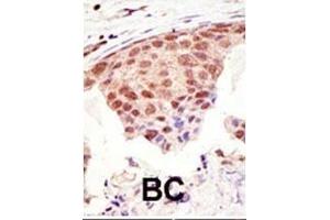 Immunohistochemistry (Paraffin-embedded Sections) (IHC (p)) image for anti-Small Ubiquitin Related Modifier Protein 1 (SUMO1) (AA 55-86), (C-Term) antibody (ABIN388027)
