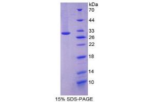 SDS-PAGE (SDS) image for Paxillin (PXN) (AA 347-578) protein (His tag) (ABIN2126229) (Paxillin Protein (PXN) (AA 347-578) (His tag))