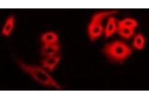 Immunofluorescent analysis of FHR3 staining in A549 cells. (CFHR3 antibody)