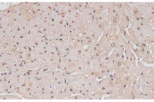 Immunohistochemistry of paraffin-embedded Rat heart using TLK1 Polyclonal Antibody at dilution of 1:100 (40x lens). (TLK1 antibody)