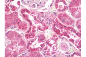 Immunohistochemistry (IHC) image for anti-Fragile Histidine Triad (FHIT) (C-Term) antibody (ABIN1895855)