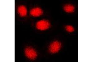 Immunofluorescent analysis of hNRNP C staining in MCF7 cells. (HNRNPC antibody  (C-Term))