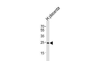 Western blot analysis of lysate from human placenta tissue lysate, using ANP32B Antibody (N-term) (ABIN1539101 and ABIN2848657). (ANP32B antibody  (N-Term))