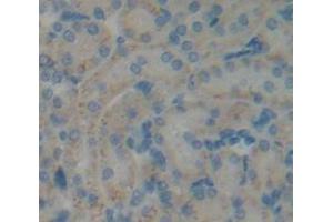 IHC-P analysis of Kidney tissue, with DAB staining. (COQ6 antibody  (AA 1-476))