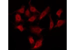ABIN6275988 staining HepG2 by IF/ICC. (GPR37L1 antibody  (N-Term))