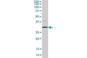 CDK4 monoclonal antibody (M08A), clone 3E7 Western Blot analysis of CDK4 expression in HeLa . (CDK4 antibody  (AA 211-303))