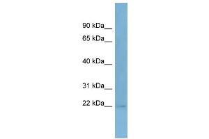 WB Suggested Anti-TASP1  Antibody Titration: 0. (TASP1 antibody  (Middle Region))