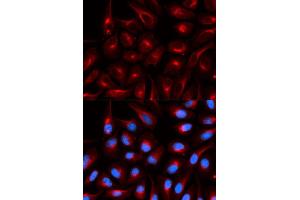 Immunofluorescence (IF) image for anti-Transducin-Like Enhancer of Split 1 (E(sp1) Homolog, Drosophila) (TLE1) antibody (ABIN1876687) (TLE1 antibody)