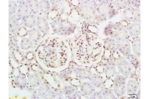 Formalin-fixed and mouse kidney tissue labeled with Anti-Defensin-beta2/DEFB2/HBD-2 Polyclonal Antibody, Unconjugated  at 1:200 followed by conjugation to the secondary antibody and DAB staining (beta 2 Defensin antibody  (AA 21-71))