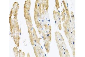 Immunohistochemistry of paraffin-embedded Rat heart using COPB2 Polyclonal Antibody at dilution of 1:100 (40x lens).