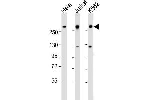 All lanes : Anti-CHD3 Antibody (N-Term) at 1:1000-1:2000 dilution Lane 1: Hela whole cell lysate Lane 2: Jurkat whole cell lysate Lane 3: K562 whole cell lysate Lysates/proteins at 20 μg per lane. (CHD3 antibody  (AA 595-629))