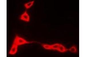 Immunofluorescent analysis of HLA-DRB1 staining in A549 cells.