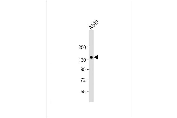 TMPRSS15 antibody  (C-Term)