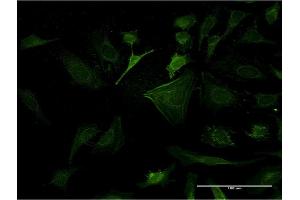 Immunofluorescence of monoclonal antibody to CASP10 on HeLa cell. (Caspase 10 antibody  (AA 1-110))