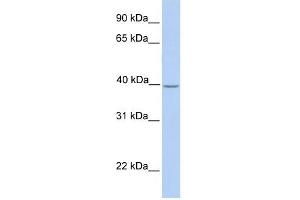 SAMSN1 antibody used at 1 ug/ml to detect target protein. (SAMSN1 antibody  (Middle Region))