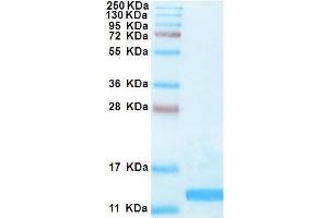High Mobility Group Box 1 (HMGB1) (BoxB) (Active) protein