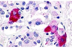 Image no. 2 for anti-G Protein-Coupled Receptor 21 (GPR21) (Transmembrane Domain) antibody (ABIN1048778) (GPR21 antibody  (Transmembrane Domain))