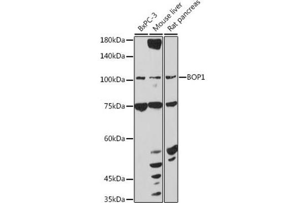 BOP1 抗体  (AA 600-680)