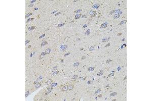 Immunohistochemistry of paraffin-embedded rat brain using ALDH1A1 antibody (ABIN5970911) at dilution of 1/100 (40x lens). (ALDH1A1 antibody)