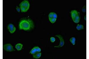 Immunofluorescent analysis of MCF-7 cells using ABIN7156348 at dilution of 1:100 and Alexa Fluor 488-congugated AffiniPure Goat Anti-Rabbit IgG(H+L) (INSIG1 antibody  (AA 1-87))