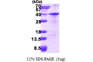 ZFAND3 Protein (AA 1-227) (His tag)