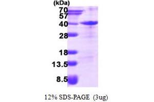 SDS-PAGE (SDS) image for Zinc Finger, AN1-Type Domain 3 (ZFAND3) (AA 1-227) protein (His tag) (ABIN668015) (ZFAND3 Protein (AA 1-227) (His tag))