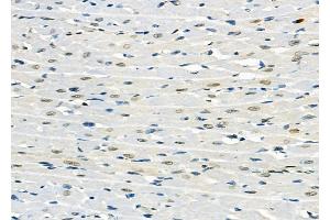 ABIN6257906 and ABIN6274713 at 1/100 staining Rat heart tissue by IHC-P.