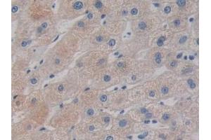Detection of DCLK1 in Human Liver Tissue using Polyclonal Antibody to Doublecortin Like Kinase 1 (DCLK1) (DCLK1 antibody  (AA 390-647))