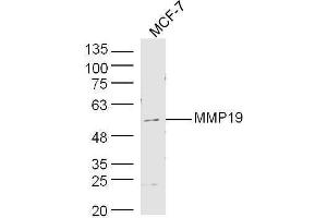 Human MCF-7 cell lysates probed with Rabbit Anti-MMP19 Polyclonal Antibody, Unconjugated  at 1:500 for 90 min at 37˚C. (MMP19 antibody  (AA 251-350))