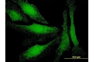 Immunofluorescence of monoclonal antibody to LMO3 on HeLa cell. (LMO3 antibody  (AA 91-146))