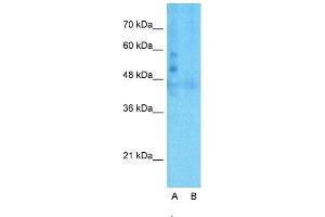 Host:  Rabbit  Target Name:  LSR  Sample Type:  Human Fetal Liver  Lane A:  Primary Antibody  Lane B:  Primary Antibody + Blocking Peptide  Primary Antibody Concentration:  1ug/ml  Peptide Concentration:  5ug/ml  Lysate Quantity:  25ug/lane/lane  Gel Concentration:  0. (LSR antibody  (C-Term))