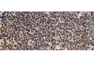Immunohistochemistry of paraffin-embedded Human tonsil tissue using SIK3 Polyclonal Antibody at dilution of 1:60(x200) (SIK3 antibody)