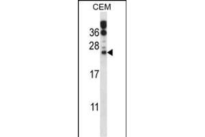 RAB6B Antibody (C-term) (ABIN657771 and ABIN2846747) western blot analysis in CEM cell line lysates (35 μg/lane). (RAB6B antibody  (C-Term))