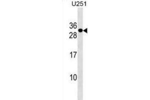 Western Blotting (WB) image for anti-POM121 and ZP3 Fusion (POMZP3) antibody (ABIN3000214) (POMZP3 antibody)