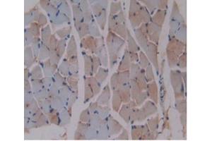 Detection of b2M in Mouse Skeletal Muscle Tissue using Monoclonal Antibody to Beta-2-Microglobulin (b2M) (beta-2 Microglobulin antibody  (AA 22-119))