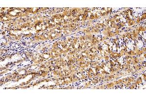 Immunohistochemistry (IHC) image for anti-Epithelial Cell Adhesion Molecule (EPCAM) (AA 25-265) antibody (ABIN7443065)