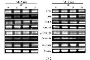 Western Blotting (WB) image for anti-Catenin (Cadherin-Associated Protein), beta 1, 88kDa (CTNNB1) (N-Term) antibody (ABIN2855042)