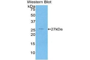 Western Blotting (WB) image for anti-Coagulation Factor XII (F12) (AA 400-615) antibody (ABIN3208108) (F12 antibody  (AA 400-615))